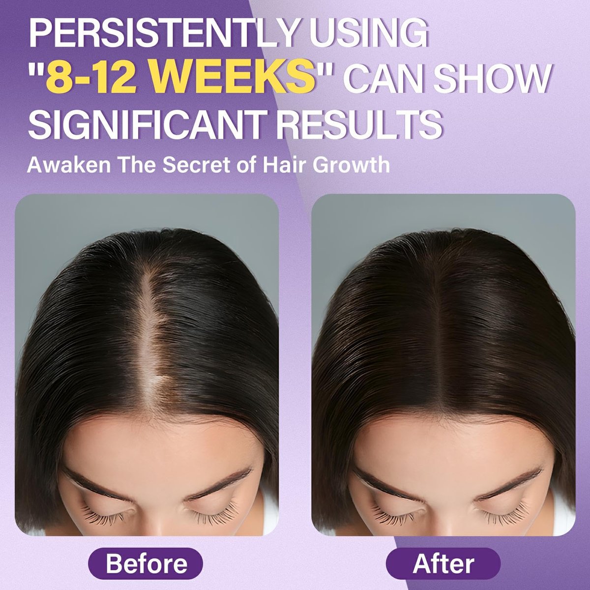 Greoay 5% Minoxidil Foam for Women - Hair Regrowth Treatment, 6.35 oz Avelisse