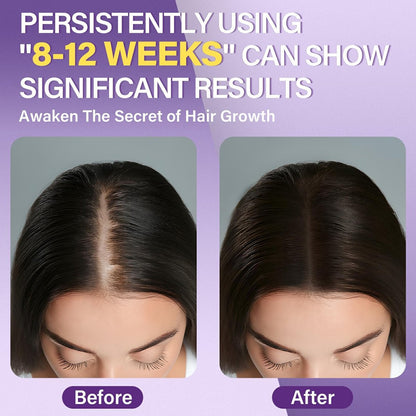 Greoay 5% Minoxidil Foam for Women - Hair Regrowth Treatment, 6.35 oz Avelisse