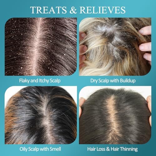 SHVYOG Scalp Scrub with Biotin & 3% Salicylic Acid – 2-in-1 Exfoliator & Clarifying Detox Shampoo for Dandruff, Itchy Scalp, Oily Hair & Dry Scalp Treatment, Includes Scalp Massager, 8.8 oz Avelisse
