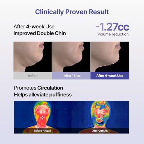 MEDITHERAPY Tension Up Mask 5EA - Korean Collagen Face V Line Lifting Mask - Hydrating Firming & Skin Tightening for Sharp & Sculpted Contour, Double Chin Reducer - Matrixyl & Peptide Gel Facial Mask Avelisse