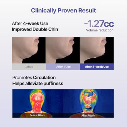 MEDITHERAPY Tension Up Mask 5EA - Korean Collagen Face V Line Lifting Mask - Hydrating Firming & Skin Tightening for Sharp & Sculpted Contour, Double Chin Reducer - Matrixyl & Peptide Gel Facial Mask Avelisse