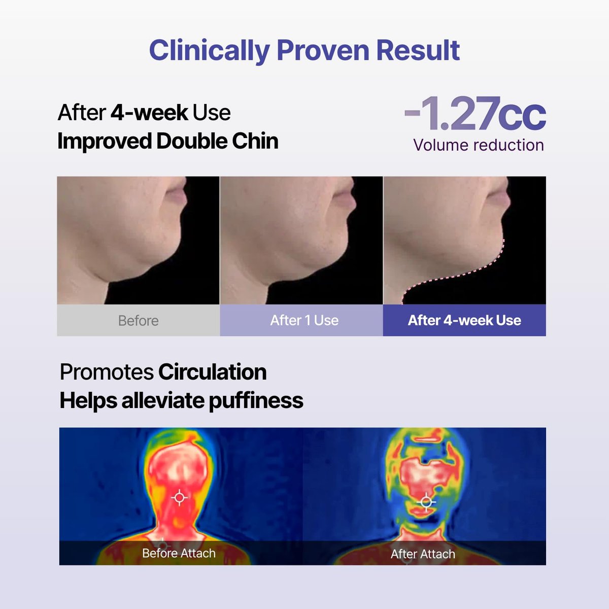MEDITHERAPY Tension Up Mask 5EA - Korean Collagen Face V Line Lifting Mask - Hydrating Firming & Skin Tightening for Sharp & Sculpted Contour, Double Chin Reducer - Matrixyl & Peptide Gel Facial Mask Avelisse