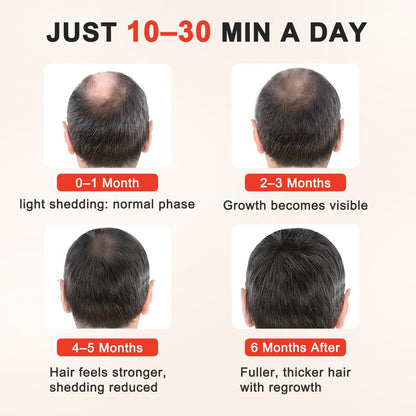 Laser Hair Growth Cap - Clinically Proven Hair Regrowth Device for Thinning Hair (Matte Black) Avelisse