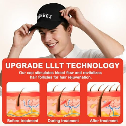 Laser Hair Growth Cap - Clinically Proven Hair Regrowth Device for Thinning Hair (Matte Black) Avelisse