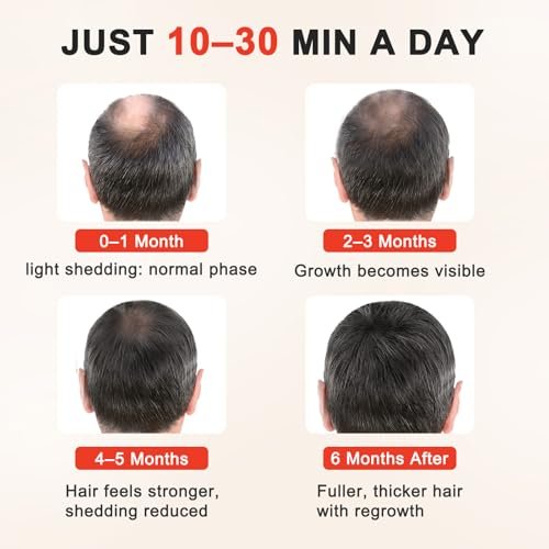 Laser Hair Growth Cap - Clinically Proven Hair Regrowth Device for Thinning Hair (Matte Black) Avelisse