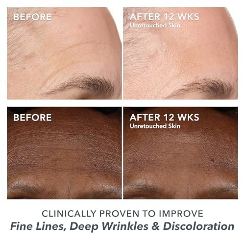 Beekman 1802 Milk RX Advanced Better Aging Wrinkle Serum – Collagen & Vitamin C Face Serum with Peptides & Goat Milk Exosomes, Retinol Alternative Avelisse