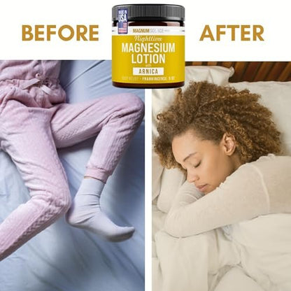 Magnum Solace Nighttime Magnesium Lotion with Arnica – Soothing Relief & Relaxation, Highly Concentrated Magnesium for Muscles & Joints, Apply to Legs or Feet Before Bed, Skin-Friendly, 5 Fl Oz