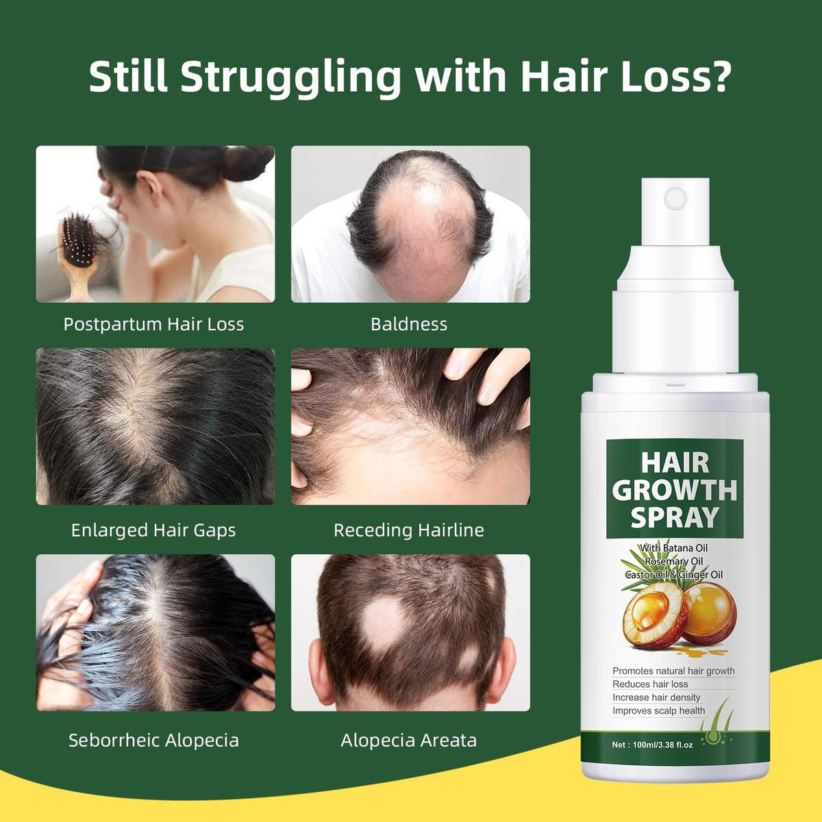 YAFUSIPE Hair Growth Oil Spray - Batana Oil with Rosemary, Castor & Ginger - Natural Hair Loss Treatment for Women & Men - Promotes Regrowth, Reduces Thinning, Strengthens Scalp - 3.38 oz - görsel 5