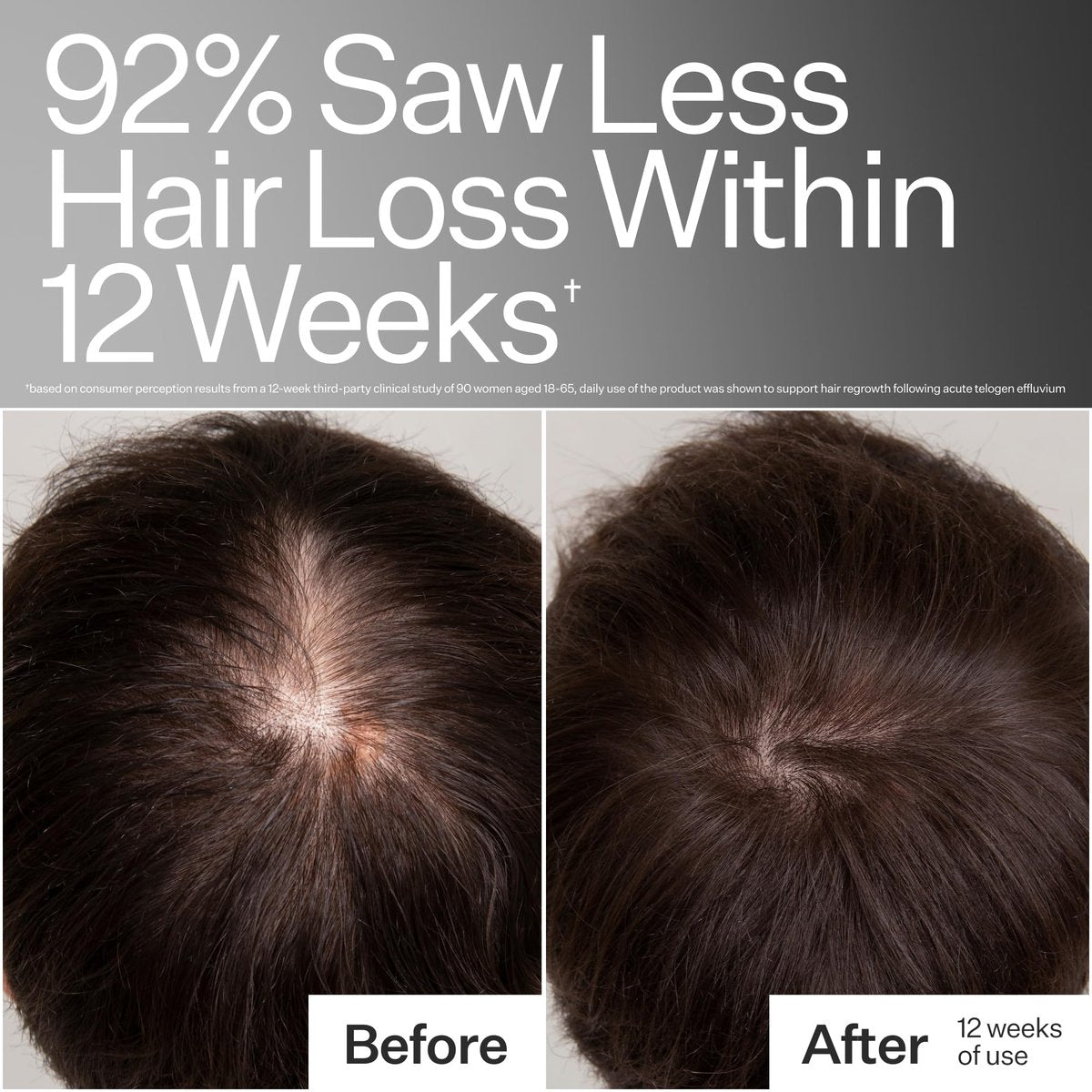 Act+ Acre Cold Processed 3% Stem Cell Peptide Treatment - Boosts Hair Density - Grape Stem Cells, Peptides + Caffeine - Vegan, Fragrance-Free - 3 Fl Oz Avelisse