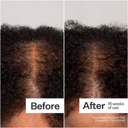 Act+ Acre Cold Processed 3% Stem Cell Peptide Treatment - Boosts Hair Density - Grape Stem Cells, Peptides + Caffeine - Vegan, Fragrance-Free - 3 Fl Oz Avelisse