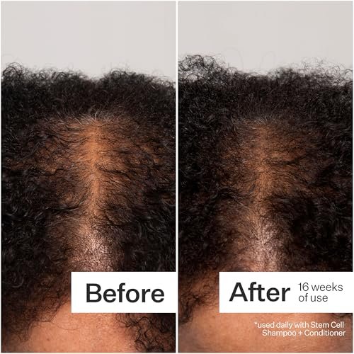 Act+ Acre Cold Processed 3% Stem Cell Peptide Treatment - Boosts Hair Density - Grape Stem Cells, Peptides + Caffeine - Vegan, Fragrance-Free - 3 Fl Oz Avelisse
