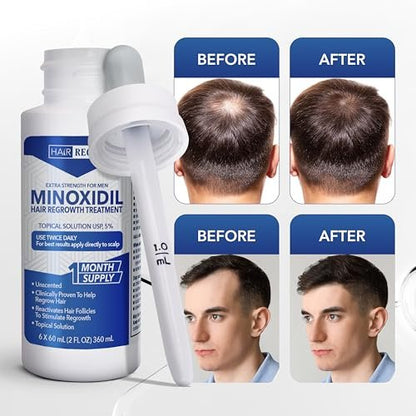 Hair Regen Liquid Minoxidil for Men 5% - Extra Strength Topical Solution for Hair Regrowth - 1 Month Supply (2 Fl Oz)