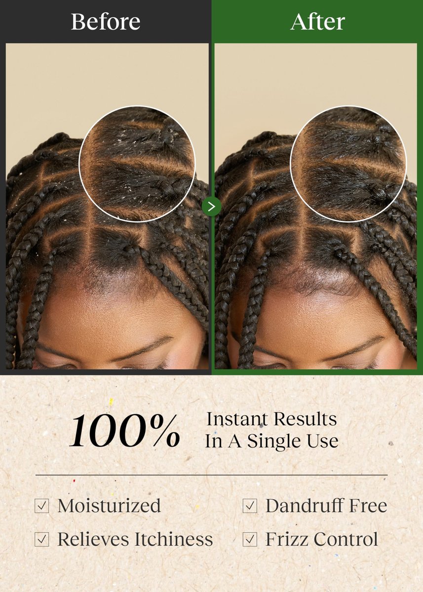 Bephor Braid Rev Scalp Cleansing Toner Pad – Korean Scalp Treatment with Apple Cider Vinegar, No-Rinse, Itchy Relief, Moisturizing, Travel Kit (5 Sheets) Avelisse