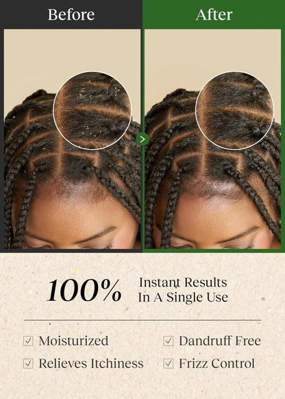 Bephor Braid Rev Scalp Cleansing Toner Pad – Korean Scalp Treatment with Apple Cider Vinegar, No-Rinse, Itchy Relief, Moisturizing, Travel Kit (5 Sheets) Avelisse