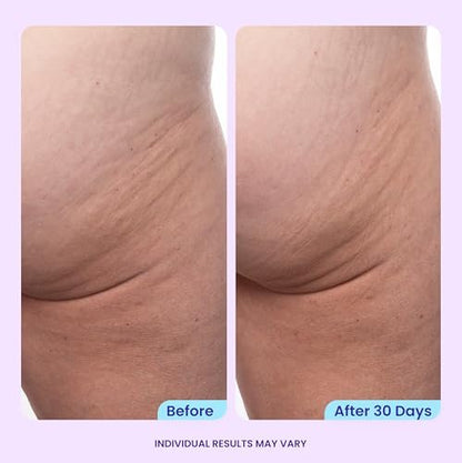 goPure Firming Butt & Thigh Cream - Skin Tightening Cream with 8% MaxLift3 Complex, Visibly Smooths Stretch Marks & Cellulite, Clinically Tested Avelisse