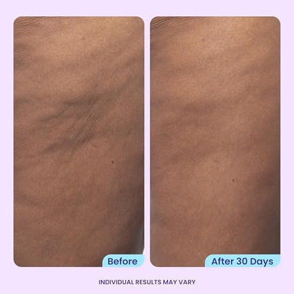 goPure Firming Butt & Thigh Cream - Skin Tightening Cream with 8% MaxLift3 Complex, Visibly Smooths Stretch Marks & Cellulite, Clinically Tested Avelisse
