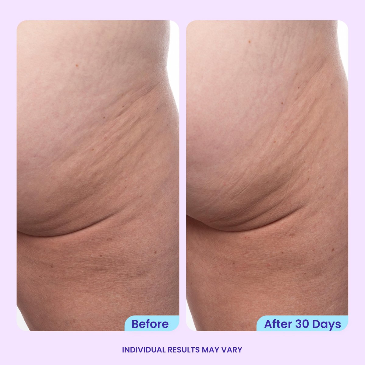 goPure Firming Butt & Thigh Cream - Skin Tightening Cream with 8% MaxLift3 Complex, Visibly Smooths Stretch Marks & Cellulite, Clinically Tested Avelisse
