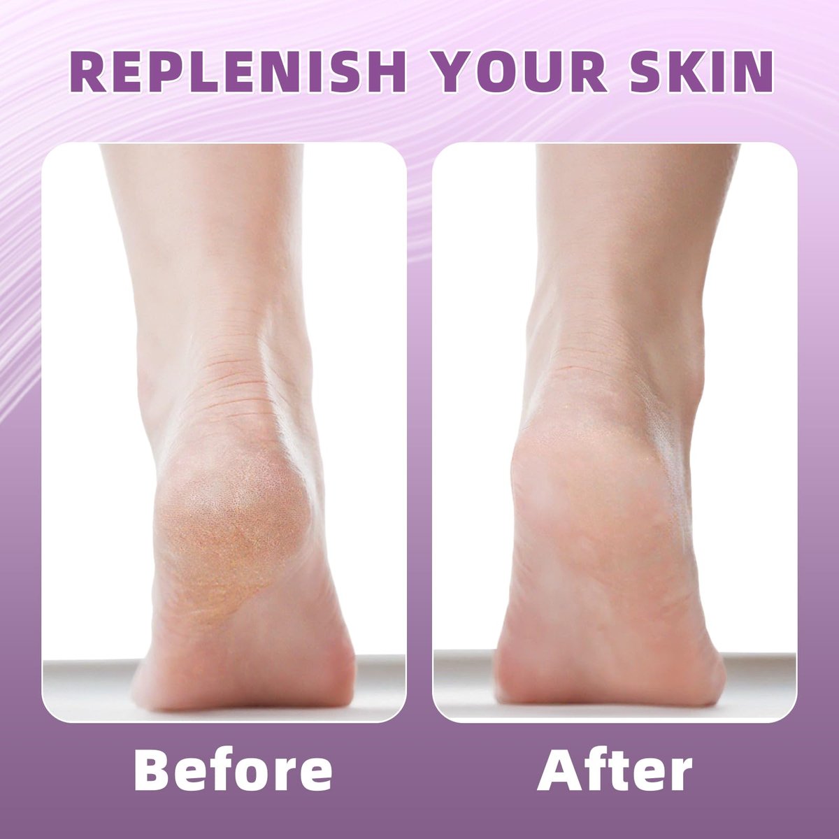 2 Pairs Silicone Socks for Dry Cracked Feet Women - Moisturizing Heel Socks, Gel Toeless Lotion Sock, Moisture Silicone Foot Sock for Cracked Heels Overnight by Untrytb - görsel 10