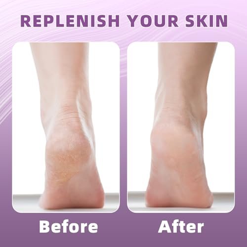 2 Pairs Silicone Socks for Dry Cracked Feet Women - Moisturizing Heel Socks, Gel Toeless Lotion Sock, Moisture Silicone Foot Sock for Cracked Heels Overnight by Untrytb - görsel 9