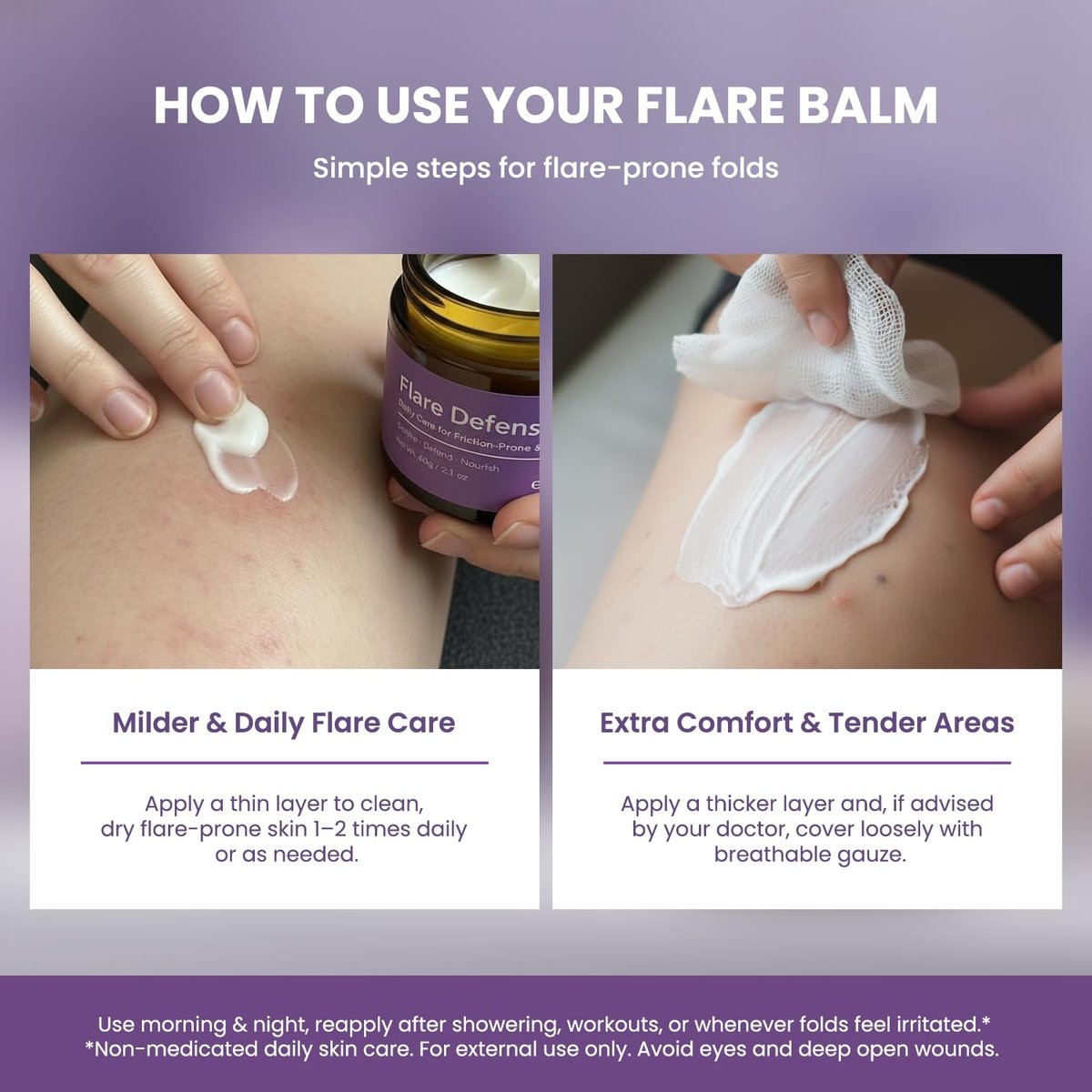 Easment Hidradenitis Suppurativa Flare Defense Balm - Science-Backed Daily Protection for Flare-Prone, Bump-Prone Skin with Microsilver BG™, Zinc Oxide & Botanical Blend, 2 oz Avelisse