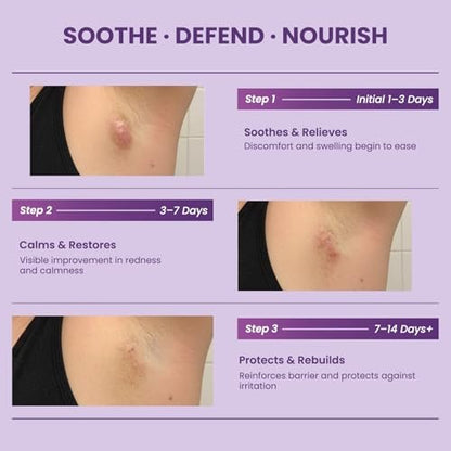 Easment Hidradenitis Suppurativa Flare Defense Balm - Science-Backed Daily Protection for Flare-Prone, Bump-Prone Skin with Microsilver BG™, Zinc Oxide & Botanical Blend, 2 oz Avelisse