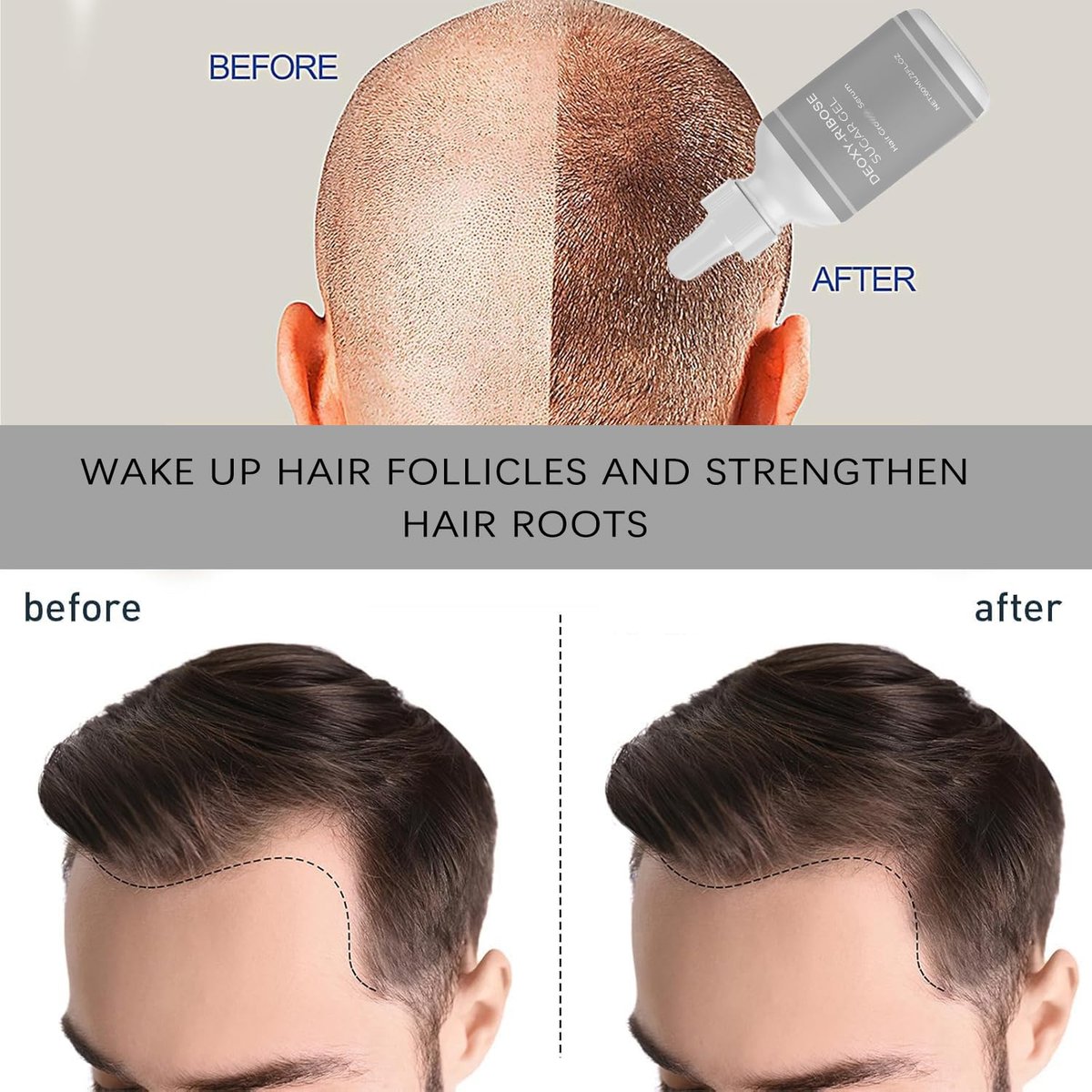 Deoxyribose Sugar Gel for Hair Growth – Strengthen & Revitalize Hair for Men and Women (2-Pack, 2.03 Fl Oz Each) Avelisse