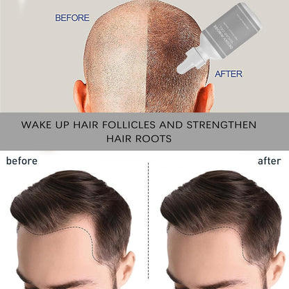 Deoxyribose Sugar Gel for Hair Growth – Strengthen & Revitalize Hair for Men and Women (2-Pack, 2.03 Fl Oz Each) Avelisse
