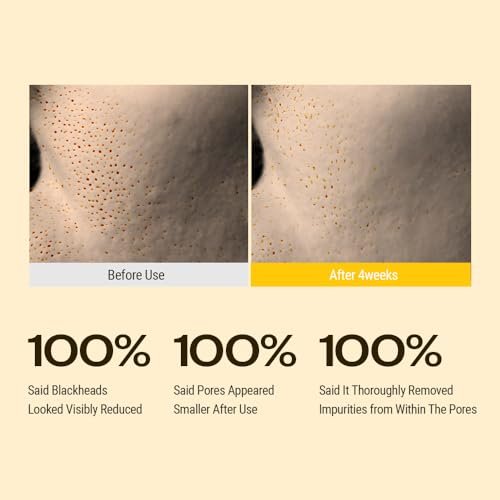 YUMU Coix Seed Deep Pore Cleansing Oil with Vitamin E & BHA – Gentle Makeup Remover & Blackhead Remover, No Oily Residue, Korean Skin Care, 6.76 fl oz Avelisse