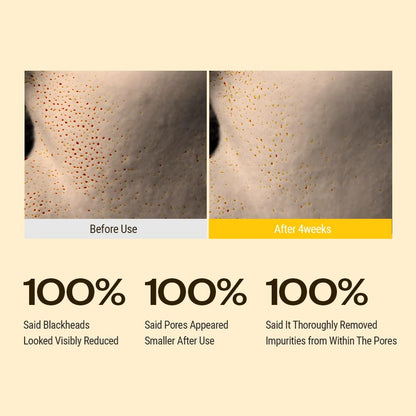 YUMU Coix Seed Deep Pore Cleansing Oil with Vitamin E & BHA – Gentle Makeup Remover & Blackhead Remover, No Oily Residue, Korean Skin Care, 6.76 fl oz Avelisse