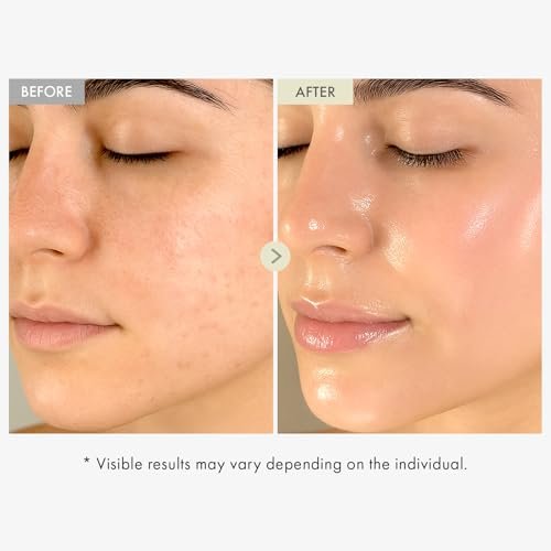 TOSOWOONG Real Collagen Face Serum – Hydrating & Firming Hydrolyzed Collagen Serum with Hyaluronic Acid for Plumping, Sagging Skin, Reduces Fine Lines & Wrinkles – Korean Skincare (33ml) - görsel 6