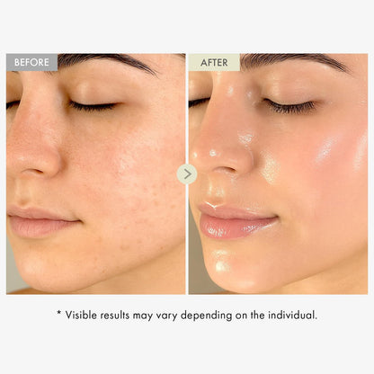 TOSOWOONG Real Collagen Face Serum – Hydrating & Firming Hydrolyzed Collagen Serum with Hyaluronic Acid for Plumping, Sagging Skin, Reduces Fine Lines & Wrinkles – Korean Skincare (33ml)