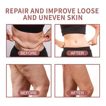 Get Dream Overnight Toning Whip - Anti-Wrinkle Moisturizing Body Firming Cream, Tighten and Lift Skin, Help Target the Appearance of Loose Skin, Suitable for All Skin Types (6.6 oz)