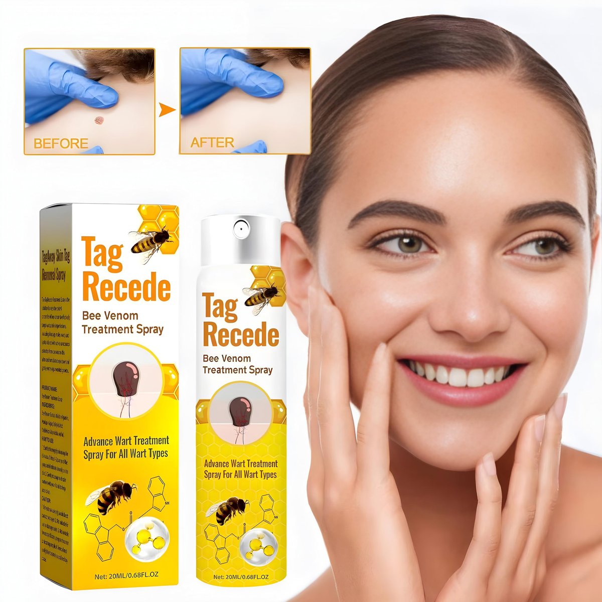 Bee Venom Spray with Salicylic Acid – Wart Remover for Body & Face (20 ml, 2 Pack) - görsel 5