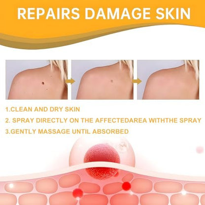 Bee Venom Spray with Salicylic Acid – Wart Remover for Body & Face (20 ml, 2 Pack)