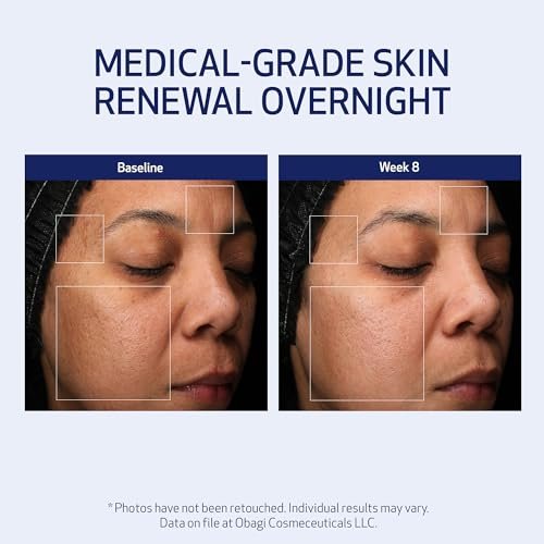 Obagi Medical Retinol + PHA Refining Night Cream – Dual-Action Anti-Aging Face Cream for Smoother, Renewed Skin & Even Complexion, 1.7 Oz Avelisse
