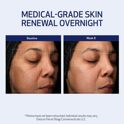 Obagi Medical Retinol + PHA Refining Night Cream – Dual-Action Anti-Aging Face Cream for Smoother, Renewed Skin & Even Complexion, 1.7 Oz Avelisse