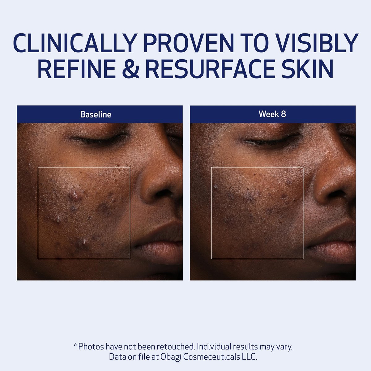 Obagi Medical Retinol + PHA Refining Night Cream – Dual-Action Anti-Aging Face Cream for Smoother, Renewed Skin & Even Complexion, 1.7 Oz Avelisse