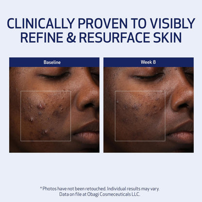 Obagi Medical Retinol + PHA Refining Night Cream – Dual-Action Anti-Aging Face Cream for Smoother, Renewed Skin & Even Complexion, 1.7 Oz Avelisse