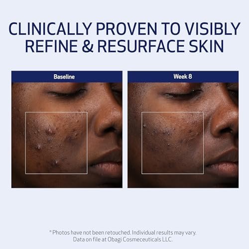 Obagi Medical Retinol + PHA Refining Night Cream – Dual-Action Anti-Aging Face Cream for Smoother, Renewed Skin & Even Complexion, 1.7 Oz Avelisse