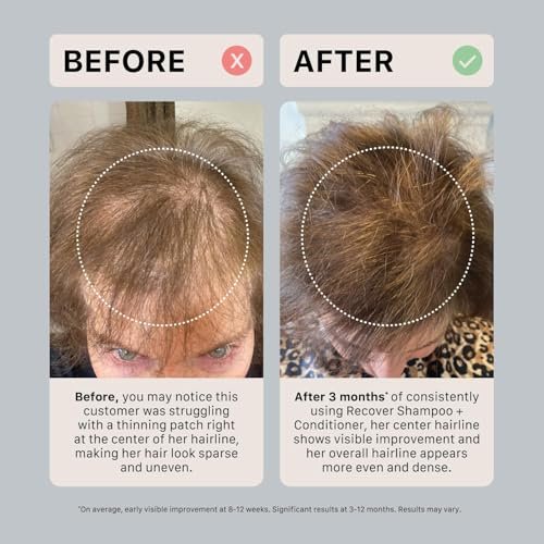 ACTIIV Ultimate Power Trio For Women – Shampoo, Conditioner & Serum for Fuller-Looking Hair, Scalp Soothing, Color-Safe, Vegan Avelisse