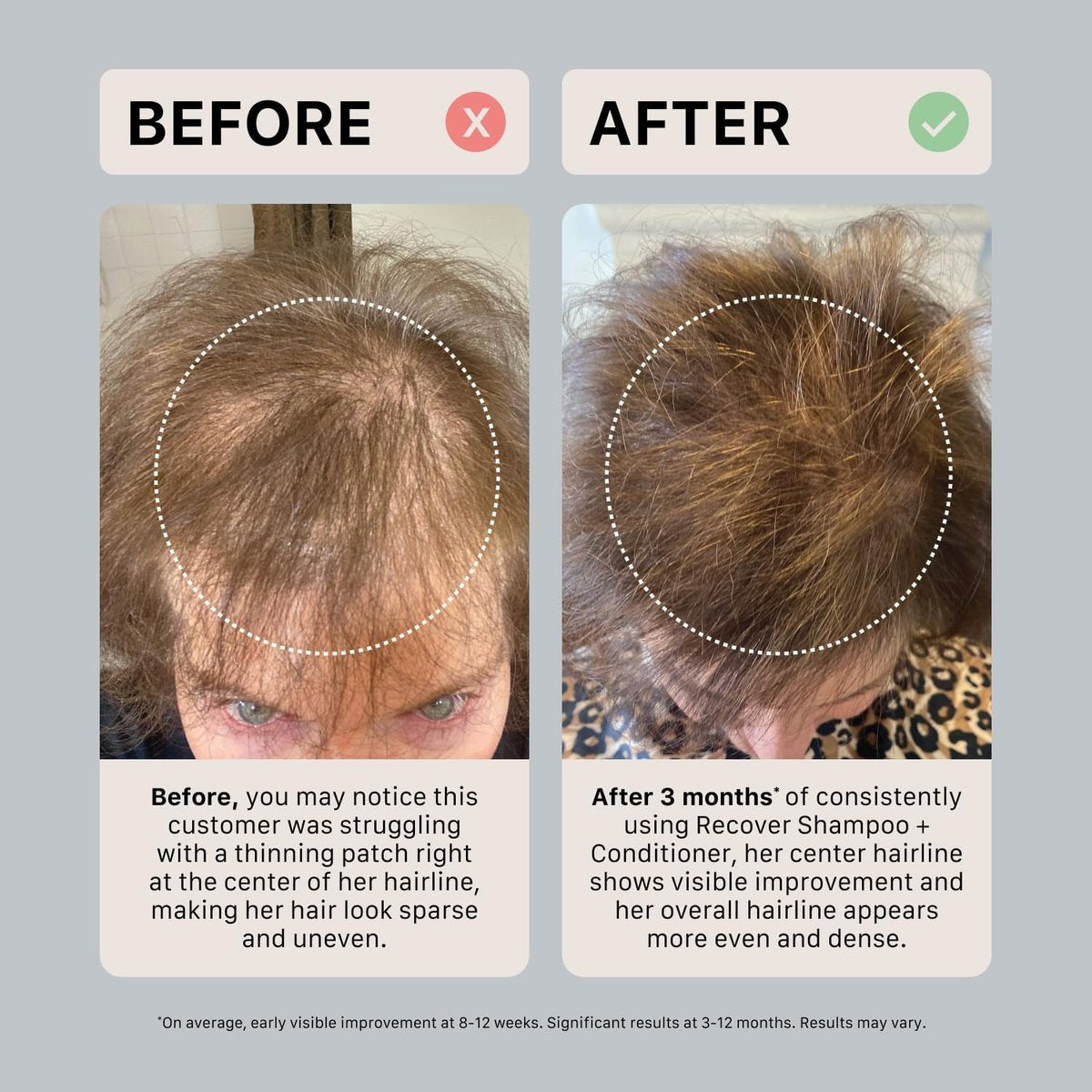 ACTIIV Ultimate Power Trio For Women – Shampoo, Conditioner & Serum for Fuller-Looking Hair, Scalp Soothing, Color-Safe, Vegan Avelisse
