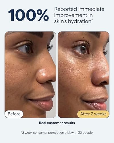 Remedy for Rich Moisture | Barrier Repairing Rich Cream Moisturizer for Normal to Dry Skin | Quadruple Ceramide Complex, Peptides, Squalane, Glycerin | By Dermatologist Dr. Shah, 1.7 fl. oz