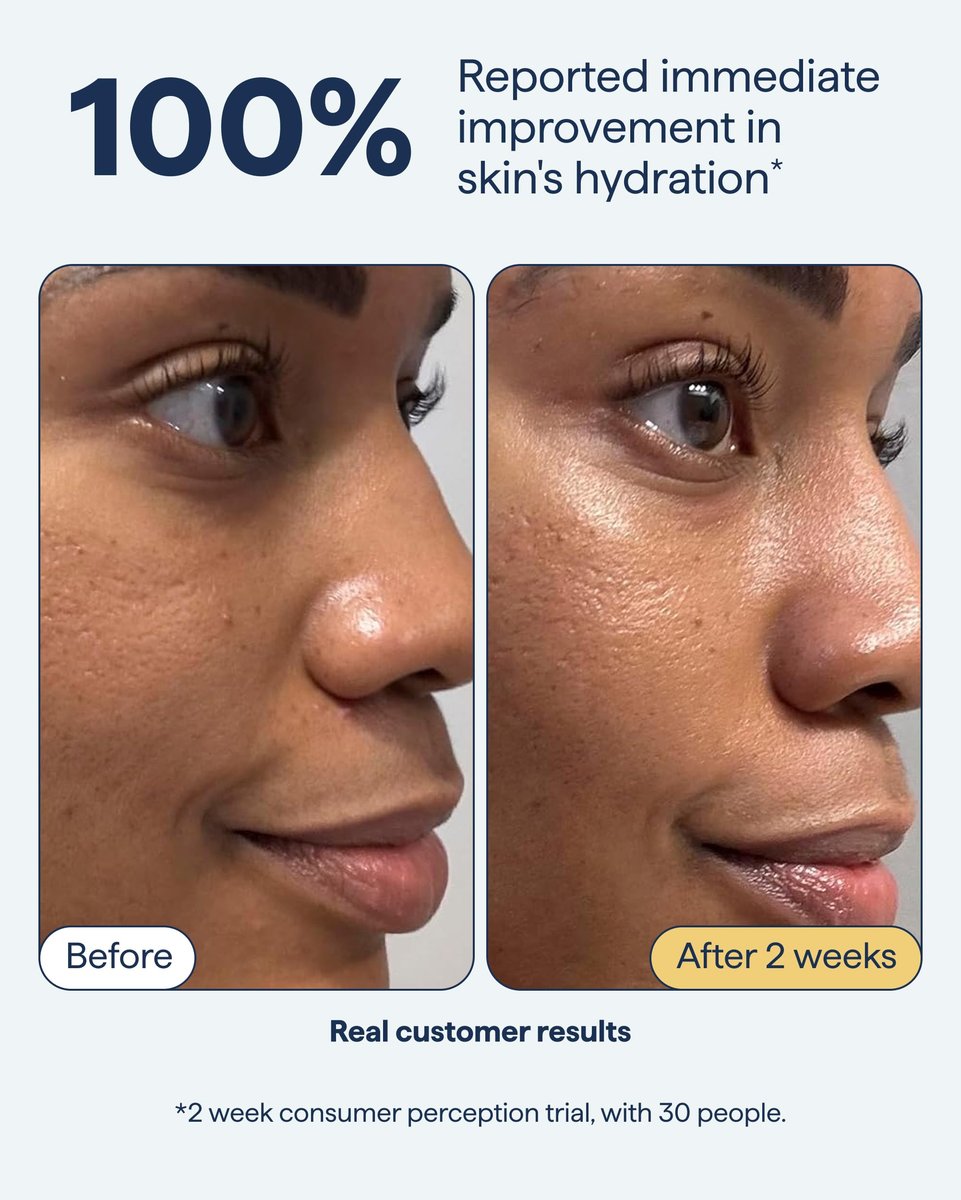 Remedy for Rich Moisture | Barrier Repairing Rich Cream Moisturizer for Normal to Dry Skin | Quadruple Ceramide Complex, Peptides, Squalane, Glycerin | By Dermatologist Dr. Shah, 1.7 fl. oz - görsel 7