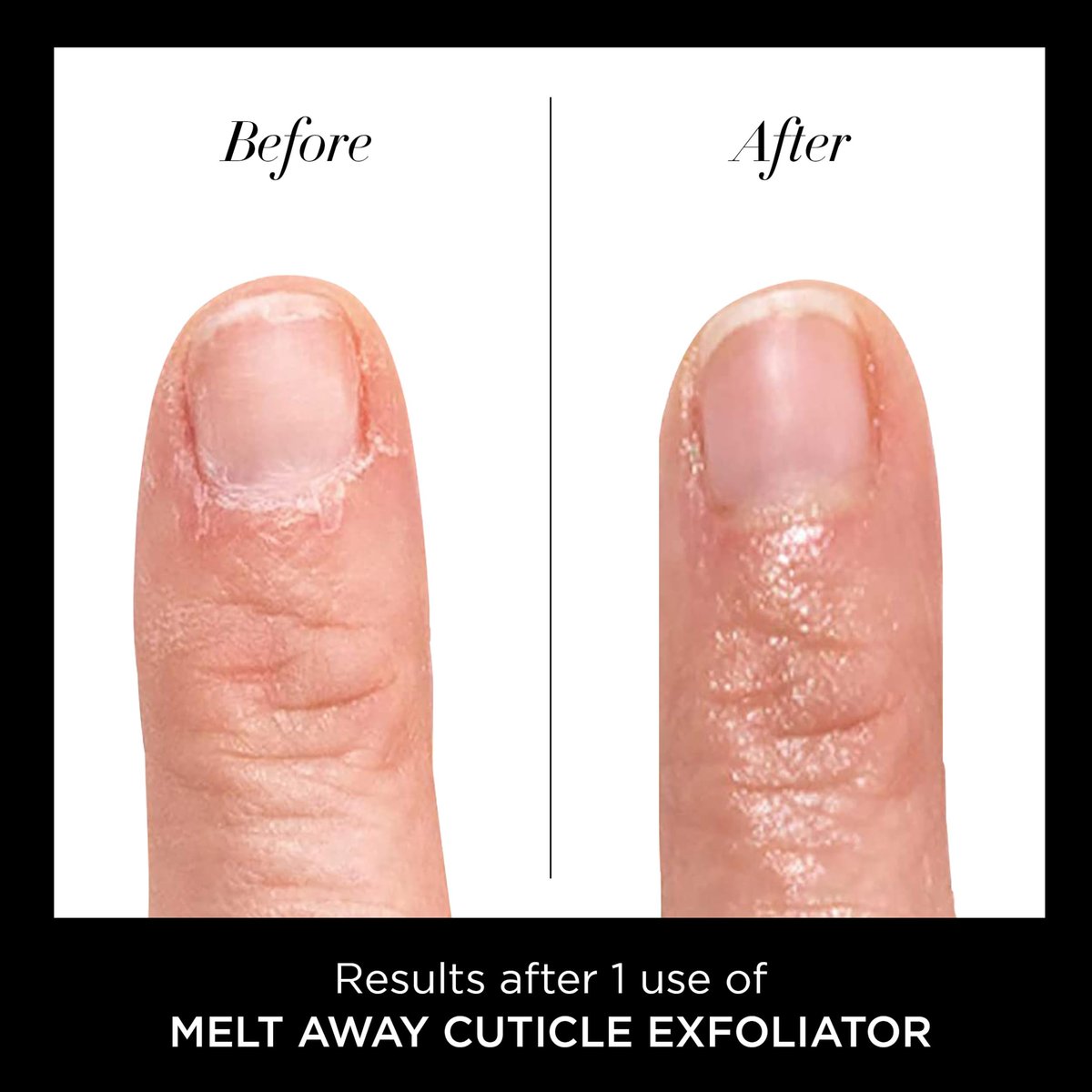 butter LONDON Cuticle Remover Liquid, Melt Away – Gentle Cuticle Softener Oil Exfoliator for Dry & Overgrown Skin, Nail Care for Home Manicure & Pedicure, 6ml (0.2 Fl Oz) - görsel 7