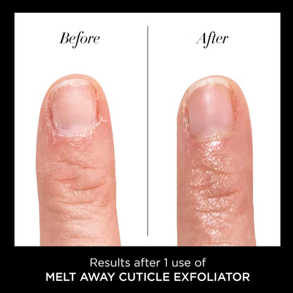 butter LONDON Cuticle Remover Liquid, Melt Away – Gentle Cuticle Softener Oil Exfoliator for Dry & Overgrown Skin, Nail Care for Home Manicure & Pedicure, 6ml (0.2 Fl Oz)