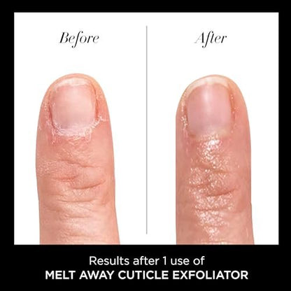 butter LONDON Cuticle Remover Liquid, Melt Away – Gentle Cuticle Softener Oil Exfoliator for Dry & Overgrown Skin, Nail Care for Home Manicure & Pedicure, 6ml (0.2 Fl Oz)