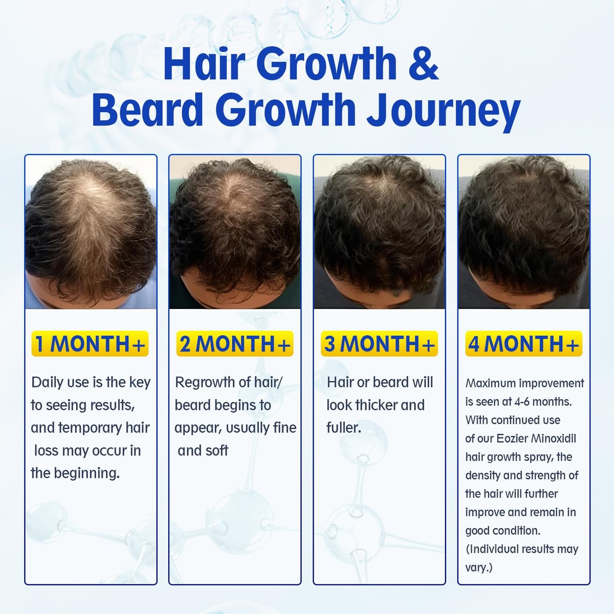 5% Minoxidil with Biotin for Women & Men – Hair Regrowth Spray, Beard & Mustache Growth, Improves Thinning Hair (4 FL OZ / 120 mL) - görsel 15