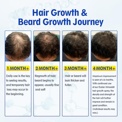 5% Minoxidil with Biotin for Women & Men – Hair Regrowth Spray, Beard & Mustache Growth, Improves Thinning Hair (4 FL OZ / 120 mL)