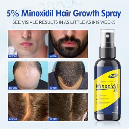 5% Minoxidil with Biotin for Women & Men – Hair Regrowth Spray, Beard & Mustache Growth, Improves Thinning Hair (4 FL OZ / 120 mL)