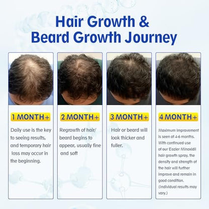 5% Minoxidil with Biotin for Women & Men – Hair Regrowth Spray, Beard & Mustache Growth, Improves Thinning Hair (4 FL OZ / 120 mL)